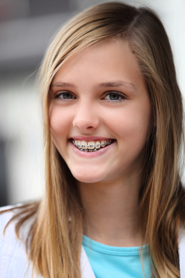 braces-faq